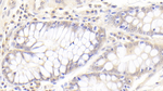 COQ10B Antibody in Immunohistochemistry (Paraffin) (IHC (P))