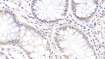 ZNF384 Polyclonal Antibody
