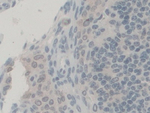 PEX1 Antibody in Immunohistochemistry (Paraffin) (IHC (P))