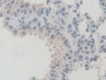 PEX1 Antibody in Immunohistochemistry (Paraffin) (IHC (P))