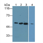 alpha Amylase 1 Polyclonal Antibody