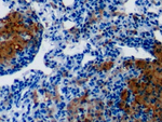 Galectin 3 Antibody in Immunohistochemistry (Paraffin) (IHC (P))