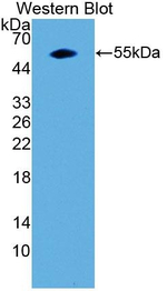 Galectin 3 Antibody in Western Blot (WB)