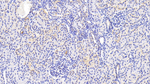 PLCL1 Antibody in Immunohistochemistry (Paraffin) (IHC (P))