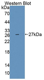 PLCL1 Antibody in Western Blot (WB)