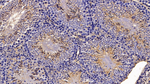 Annexin A6 Antibody in Immunohistochemistry (Paraffin) (IHC (P))