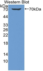 KIR2DL1 Antibody in Western Blot (WB)