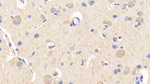 PEX2 Antibody in Immunohistochemistry (Paraffin) (IHC (P))