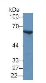 G6PD Antibody in Western Blot (WB)