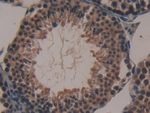 NDUFAB1 Antibody in Immunohistochemistry (Paraffin) (IHC (P))