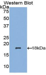 NDUFAB1 Antibody in Western Blot (WB)