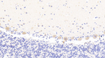 MAN1A1 Polyclonal Antibody