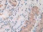 PLA2G10 Polyclonal Antibody