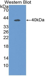 DEFB119 Polyclonal Antibody