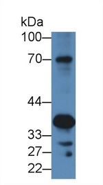 SCEL Antibody in Western Blot (WB)