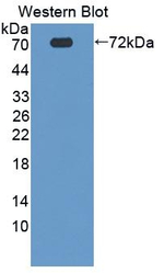 Protein Z Antibody in Western Blot (WB)