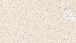 LRP5 Polyclonal Antibody