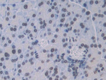 Cathepsin C Polyclonal Antibody