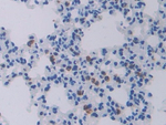 Cathepsin C Antibody in Immunohistochemistry (Paraffin) (IHC (P))