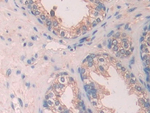 SCUBE3 Antibody in Immunohistochemistry (Paraffin) (IHC (P))