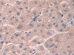 SCUBE3 Antibody in Immunohistochemistry (Paraffin) (IHC (P))