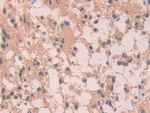 SCUBE3 Antibody in Immunohistochemistry (Paraffin) (IHC (P))