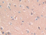 SCUBE3 Antibody in Immunohistochemistry (Paraffin) (IHC (P))