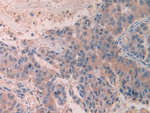 SCUBE3 Antibody in Immunohistochemistry (Paraffin) (IHC (P))