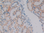 PKP1 Polyclonal Antibody