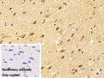 PSMC3 Antibody in Immunohistochemistry (Paraffin) (IHC (P))