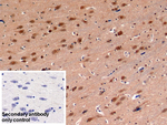 PSMC3 Antibody in Immunohistochemistry (Paraffin) (IHC (P))