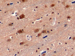 PSMC3 Antibody in Immunohistochemistry (Paraffin) (IHC (P))