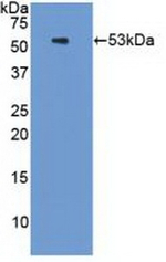 PSMC3 Antibody in Western Blot (WB)