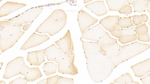 iNOS Polyclonal Antibody