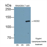 iNOS Antibody in Western Blot (WB)
