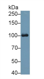 Aconitase 1 Antibody in Western Blot (WB)