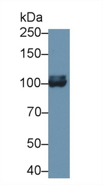 Aconitase 1 Antibody in Western Blot (WB)