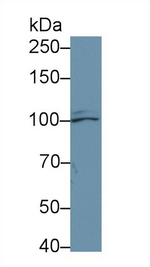 Aconitase 1 Antibody in Western Blot (WB)