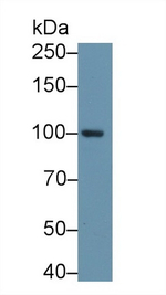 Aconitase 1 Antibody in Western Blot (WB)
