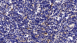 STAT5a Polyclonal Antibody
