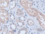 LDOC1 Antibody in Immunohistochemistry (Paraffin) (IHC (P))