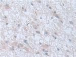 LDOC1 Antibody in Immunohistochemistry (Paraffin) (IHC (P))