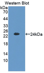 CITED1 Polyclonal Antibody