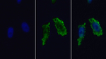 HK2 Polyclonal Antibody