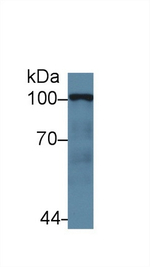 HK2 Antibody in Western Blot (WB)
