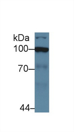 HK2 Antibody in Western Blot (WB)