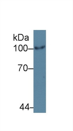 HK2 Antibody in Western Blot (WB)