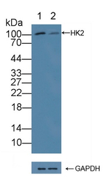 HK2 Antibody in Western Blot (WB)