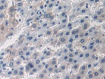 OAS1 Antibody in Immunohistochemistry (Paraffin) (IHC (P))