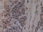 Creatine Kinase MT Antibody in Immunohistochemistry (Paraffin) (IHC (P))